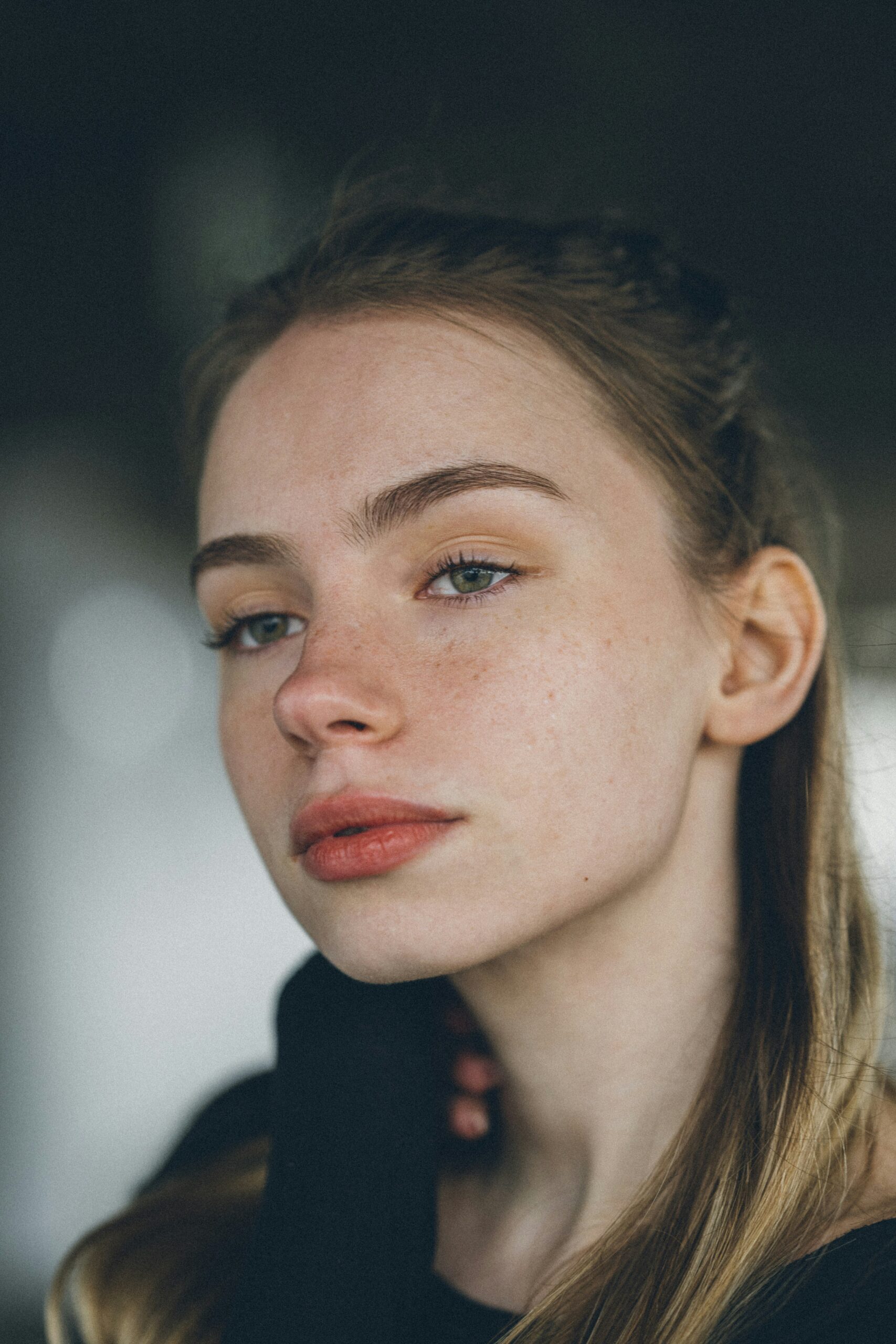 Acne Treatment